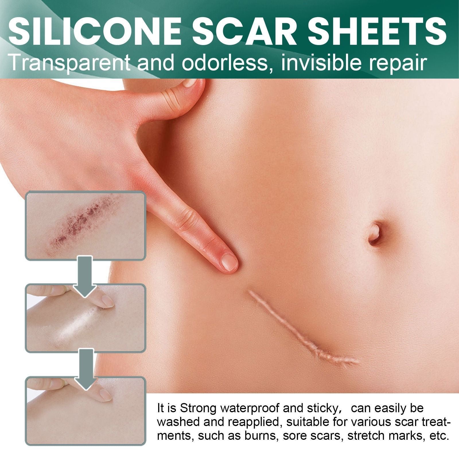Japan Hisamitsu patch, scar removal patch, cesarean section scar patch, cut and burn scar, gel hyperplastic plaster patch