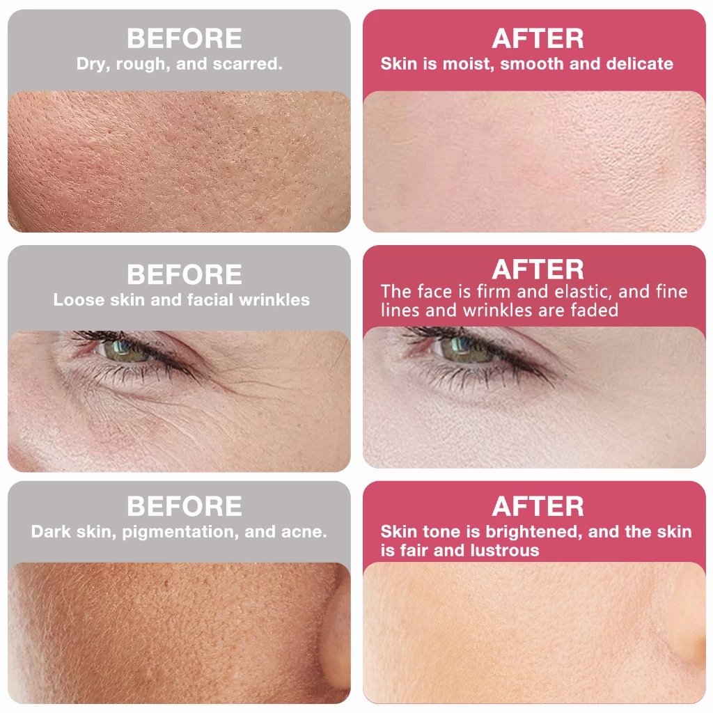 TRANSINO White C Whitening Premium (30 Days)