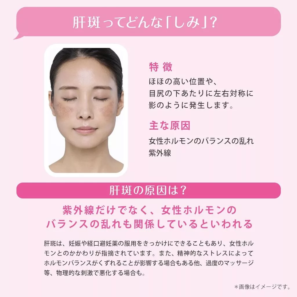 TRANSINO EX [Class 1 OTC drug] Skin Whitening Supplement Melasm 2 months Daiichi sankyo