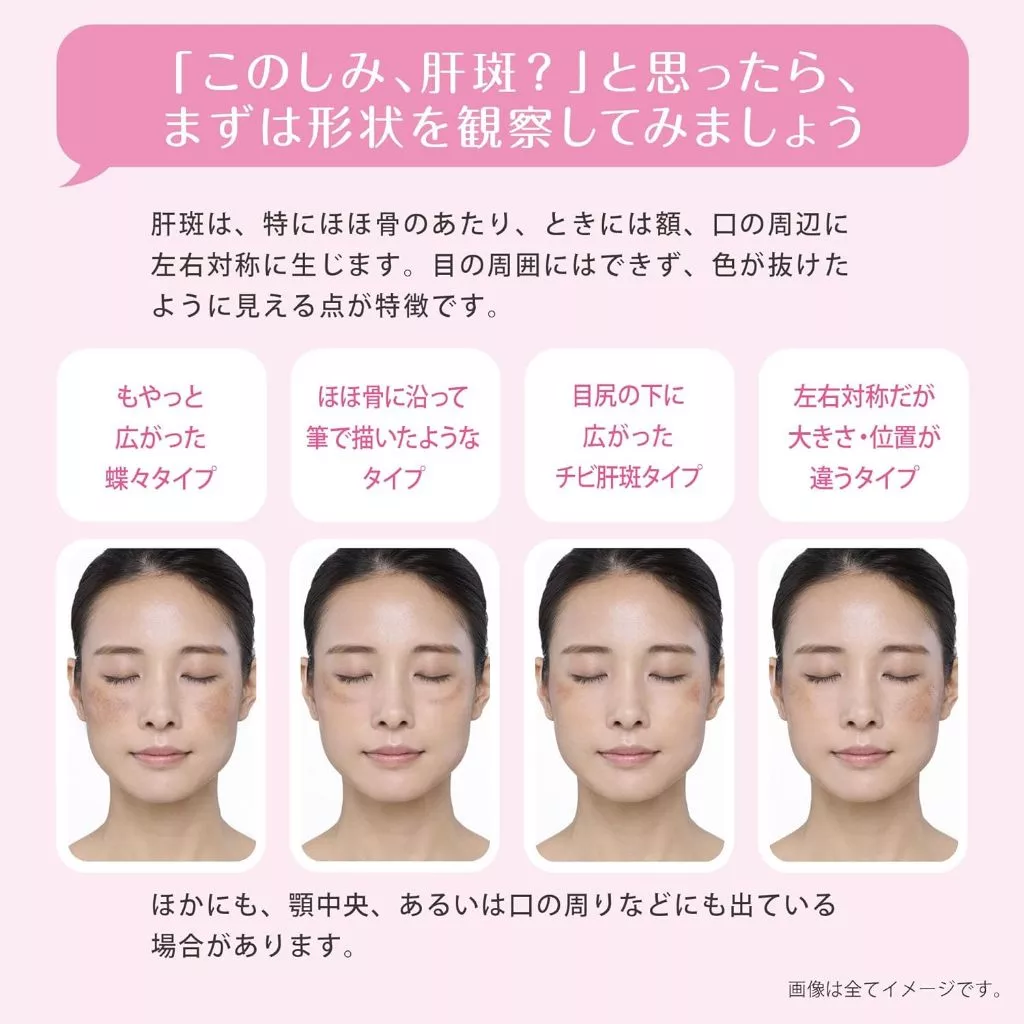 TRANSINO EX [Class 1 OTC drug] Skin Whitening Supplement Melasm 2 months Daiichi sankyo