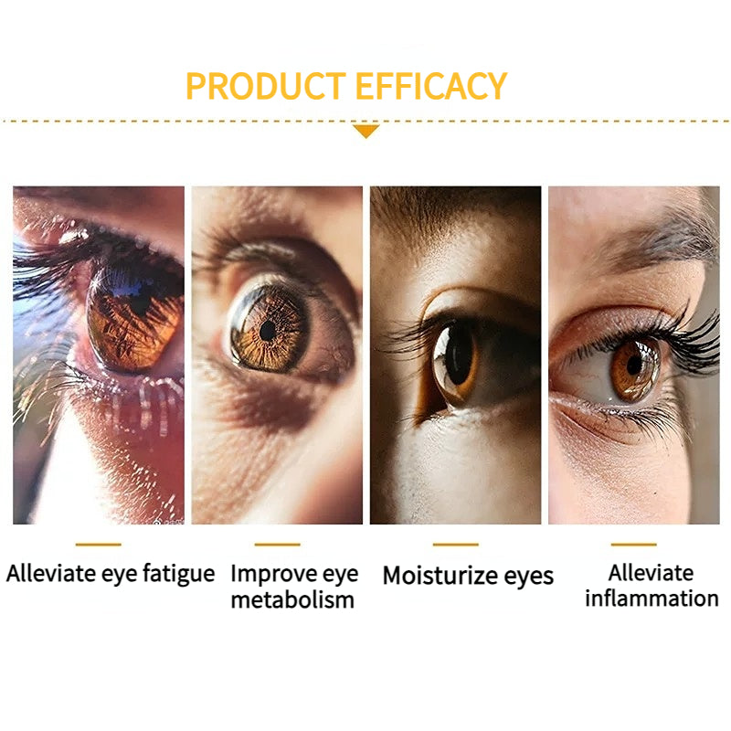 Japan Santen FX NEO eye drops, relieve eye fatigue, congestion and dryness, alleviate inflammation, remove yellow and red bloodshot 12ml